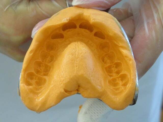 Putty as dental impression material